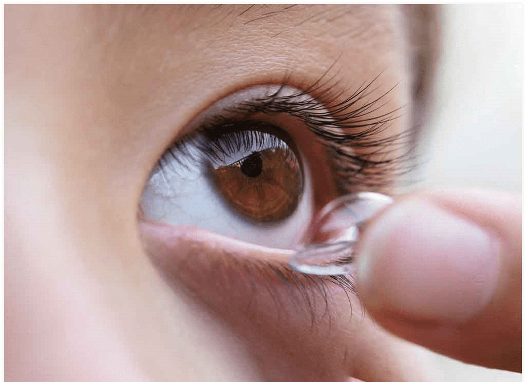 Myopia Treatment with Ortho K Lenses in Malaysia OK Lens in Malaysia